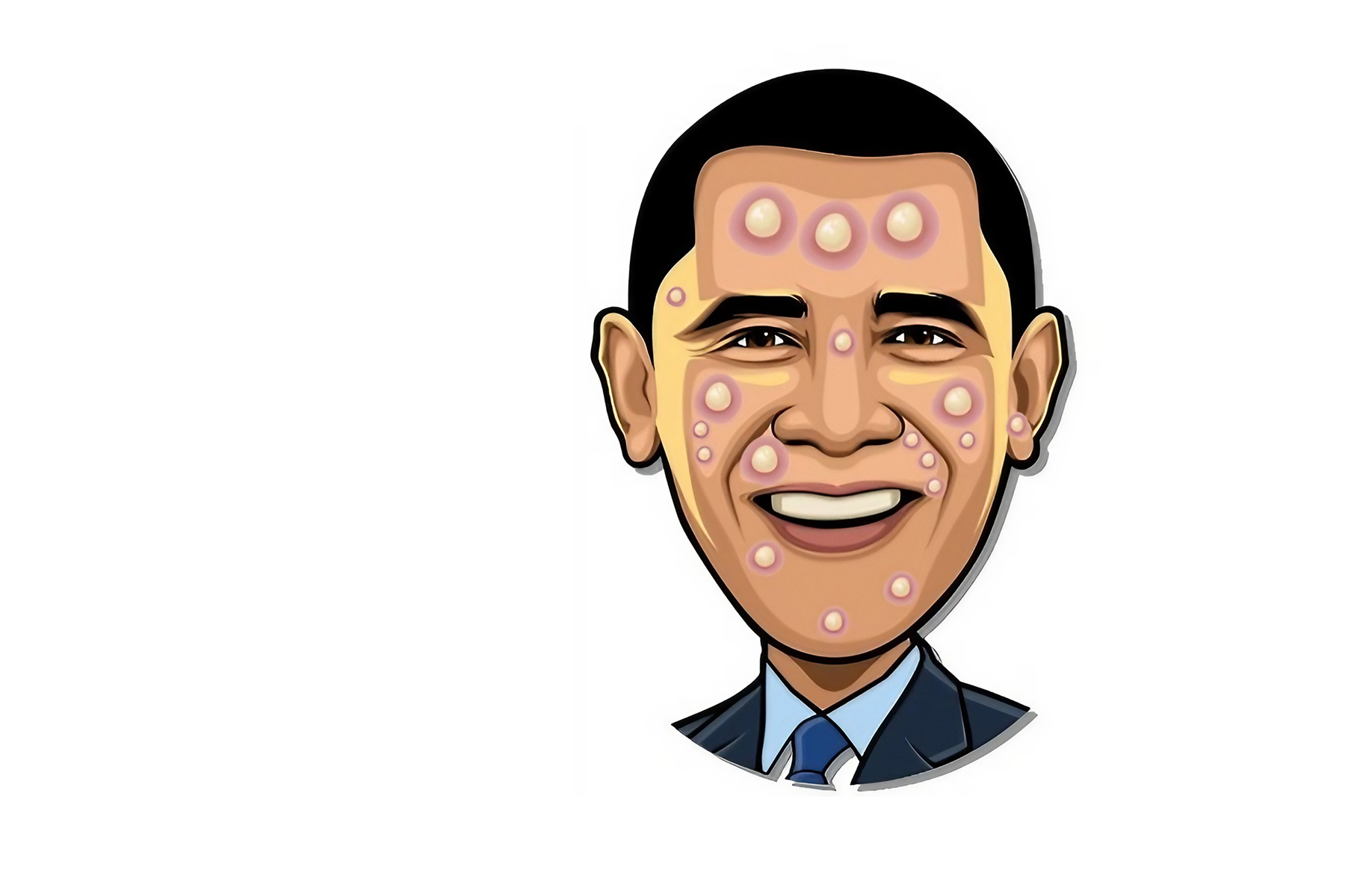 Celebrity Pimple Pop